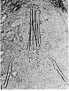 Coelogynopora hymanae Coelogynopora hymanae