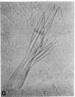Coelogynopora junxtaforcipis Coelogynopora junxtaforcipis