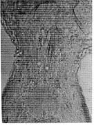 Coelogynopora junxtaforcipis Coelogynopora junxtaforcipis