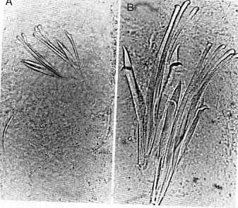 Coelogynopora nodosa