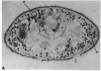 Coelogynopora poaceaglandis