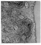 Coelogynopora poaceaglandis