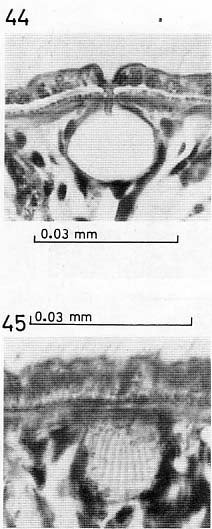 Coelogynopora tenuiformis Coelogynopora tenuiformis