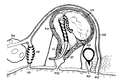 Platyhelminthes (flatworms)