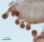 Oceania armata, stalked nematocyst clusters of the mouth margin