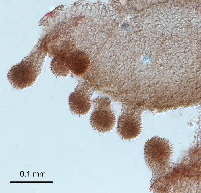 Oceania armata, stalked nematocyst clusters of the mouth margin Oceania armata, stalked nematocyst clusters of the mouth margin