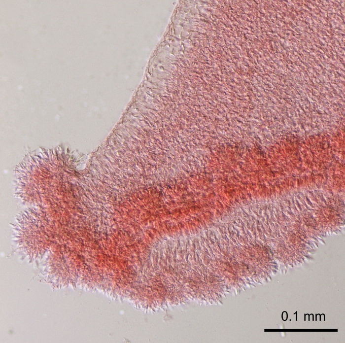 Turritopsis rubra, nematocyst clusters of mouth rim. Turritopsis rubra, nematocyst clusters of mouth rim.