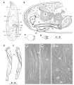 Platyhelminthes (flatworms)