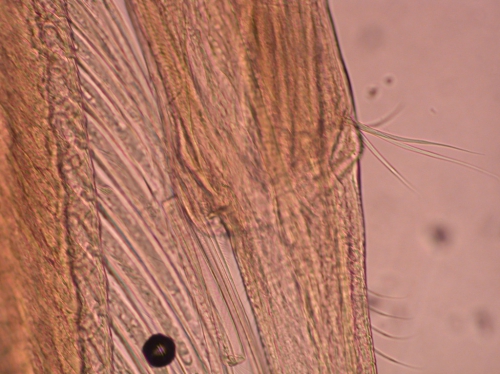 Part: Antennal peduncle