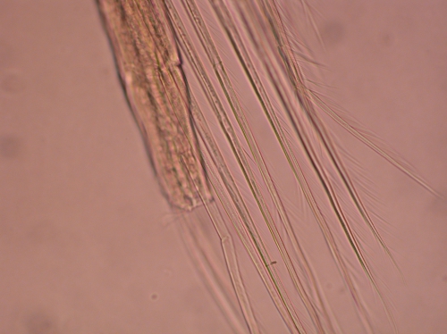 Part: Antennal scale