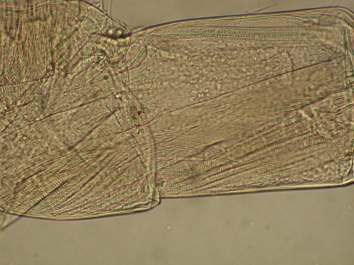 Part: Antennal peduncle