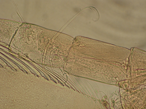 Part: Antennal peduncle