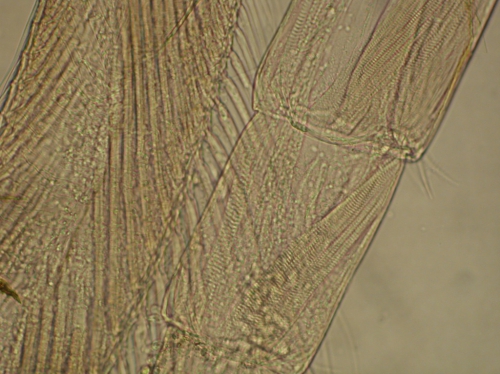 Part: Antennal peduncle