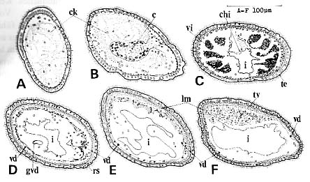 Ezoplana masacoae Ezoplana masacoae