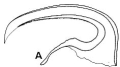 Platyhelminthes (flatworms)