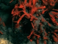 Porifera (sponges)