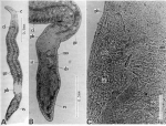 Nematoplana pullolineata