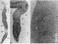 Platyhelminthes (flatworms)