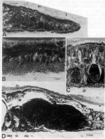 Nematoplana pullolineata