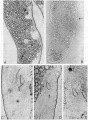 Platyhelminthes (flatworms)