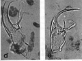 Platyhelminthes (flatworms)