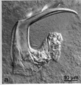 Platyhelminthes (flatworms)