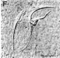 Platyhelminthes (flatworms)