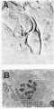 Platyhelminthes (flatworms)