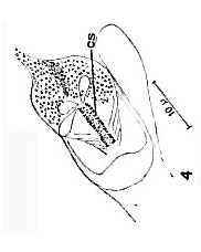 Uncinorhynchus karlingi