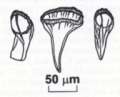 Platyhelminthes (flatworms)