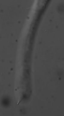 Nematoda (roundworms)