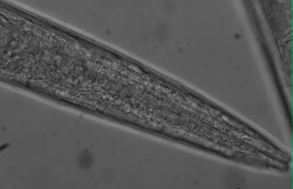 Sabatieria sp., Part: pharynx