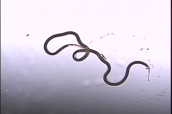 Nematoda (roundworms)