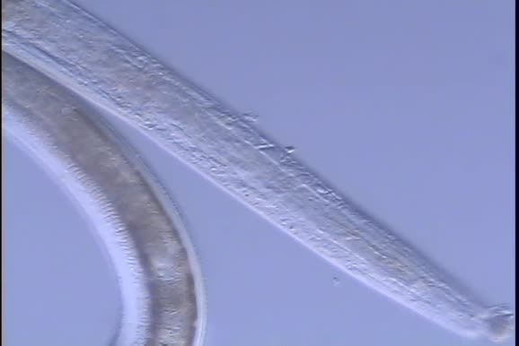 Nematoda (roundworms)