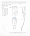 Nematoda (roundworms)