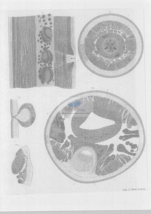 Thoracostoma setosum