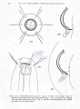 Nematoda (roundworms)