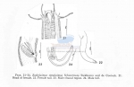 Bathylaimus stenolaimus