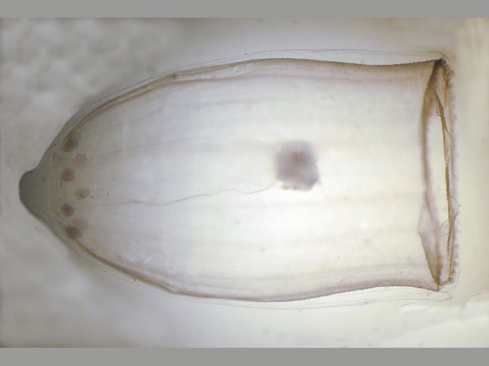 Aglantha digitale (Müller, 1776) Aglantha digitale (Müller, 1776)