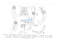 Nematoda (roundworms)