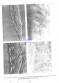 Nematoda (roundworms)