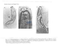 Nematoda (roundworms)