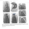 Nematoda (roundworms)