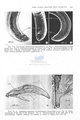 Nematoda (roundworms)