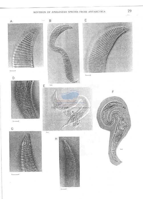 Epsilonema docidocricum