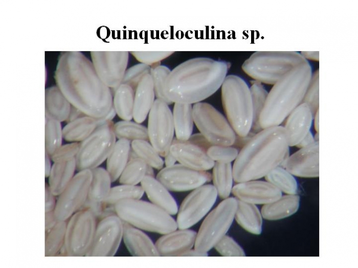 Quinqueloculina