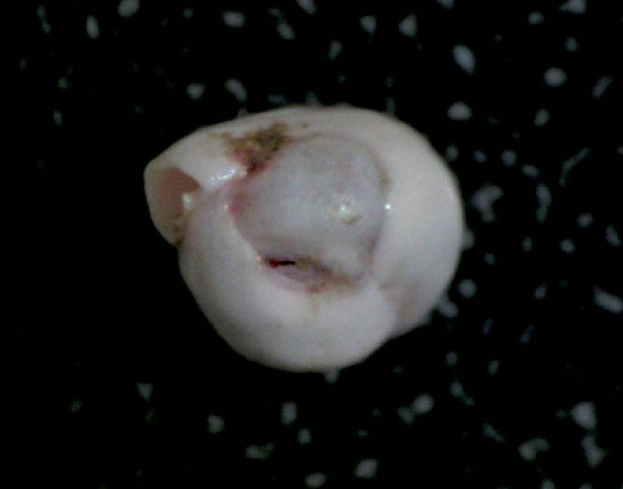 Miliolinella subrotunda Miliolinella subrotunda