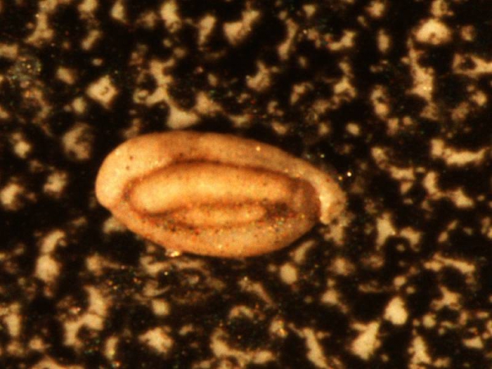 Quinqueloculina stalkeri