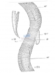 Croconema mammillatum