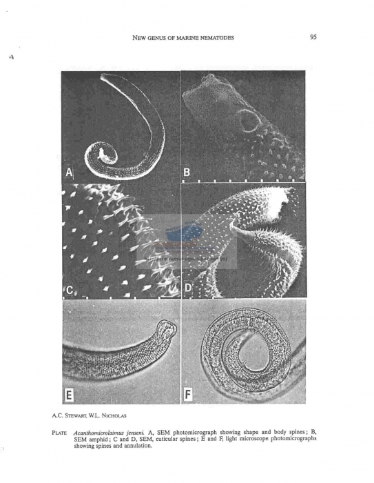 Acanthomicrolaimus jenseni